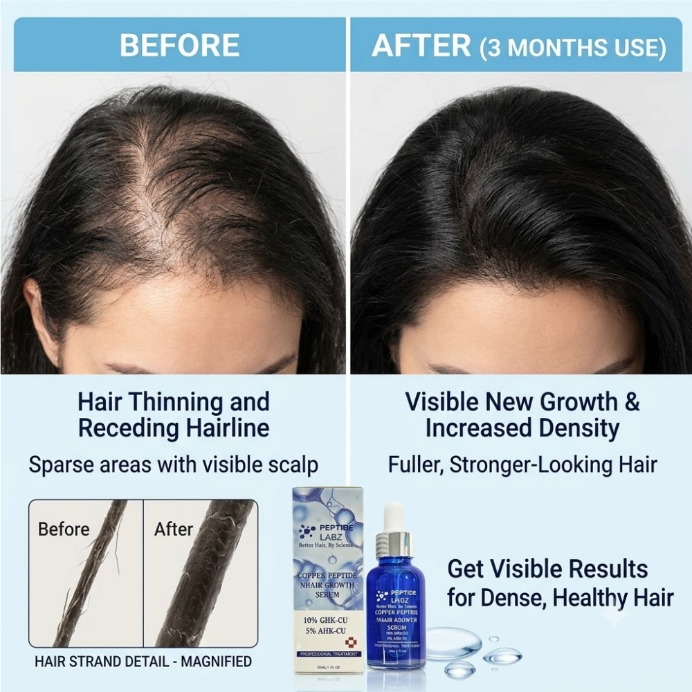 헤어 성장 에센스 구리 펩타이드 GHK Cu 탈모 방지 - Growth Factor Serum 리뷰 및 가격