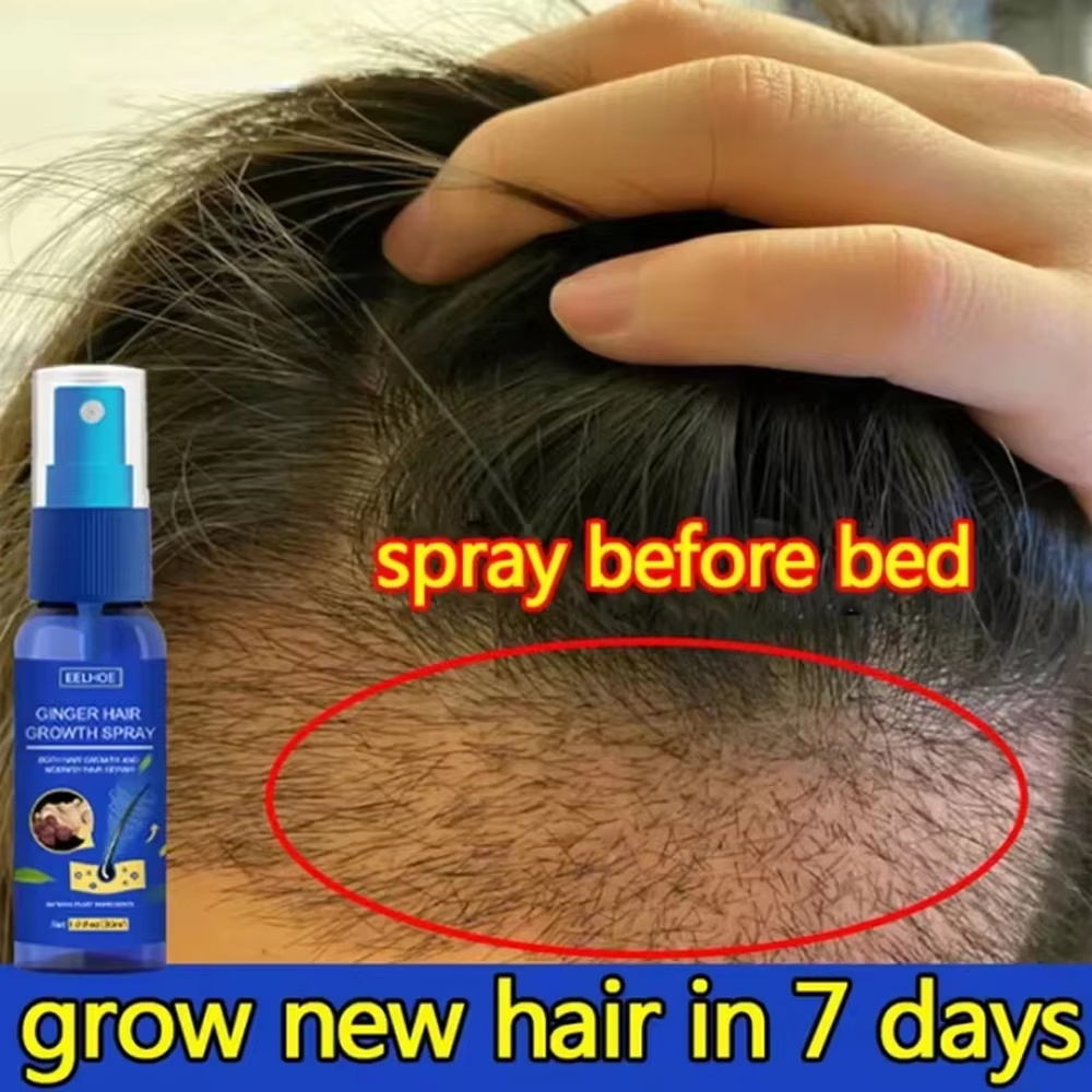 빠른 생강 모발 성장 스프레이, 모발 뿌리 강화, 탈모 - Growth Factor Serum 리뷰 및 가격